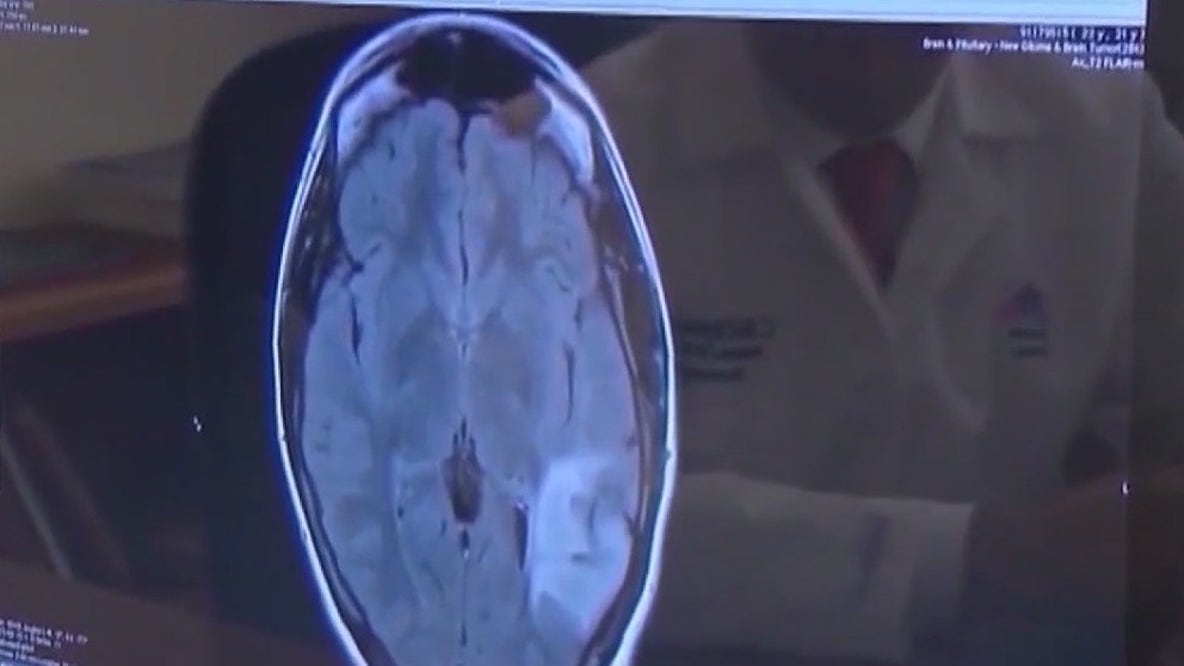 Understanding ALS following Eric Dane's diagnosis